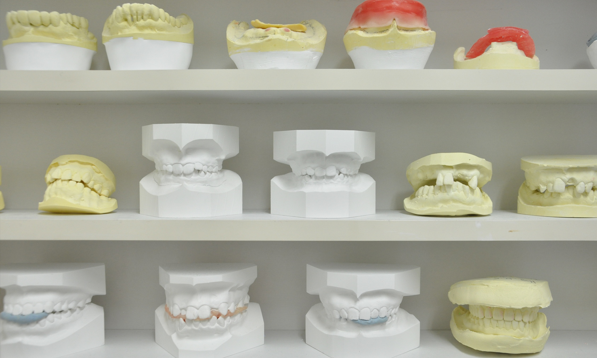 歯科技工物販売